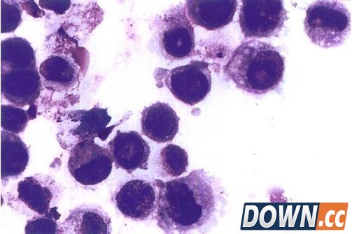 美科学家发现癌症通过寄生虫传染宿主