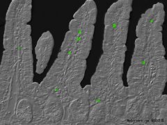 熬夜真会破坏你的免疫系统