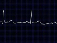 传苹果iWatch要集成心脏病预测功能