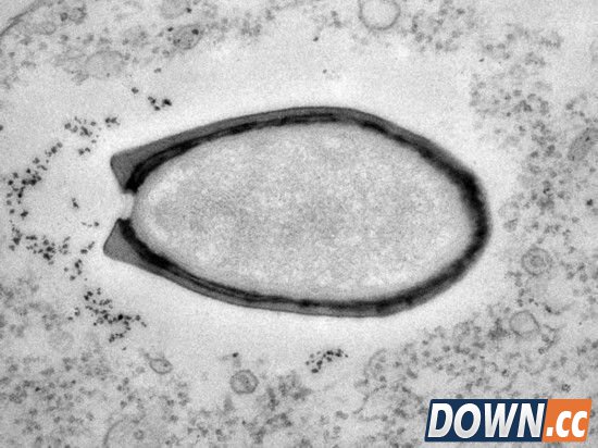 三万年前巨型病毒复活 仍具感染性