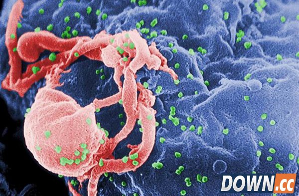 罕见：女性之间能传播艾滋病毒