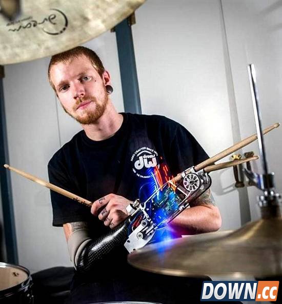 痛失右手的美国青年装上了机械手臂，有望成为专业鼓手