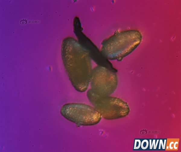 吓尿了！放大1000倍的北京雾霾