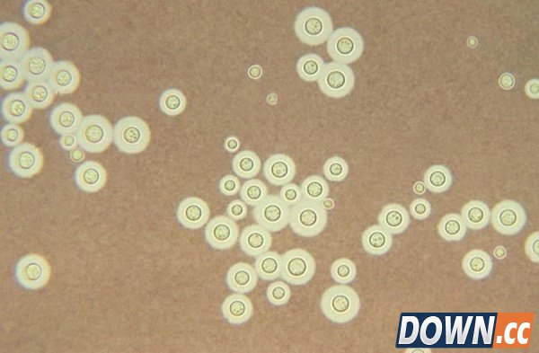 十大辐射惊人事实：切尔诺贝利“不死林地”