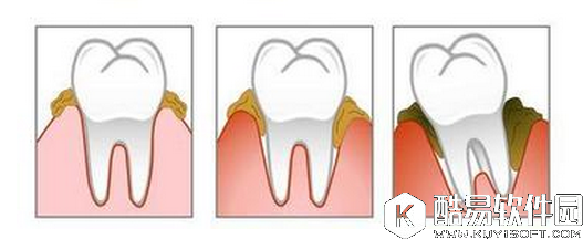 电动牙刷如何使用？电动牙刷的正确使用方法图解
